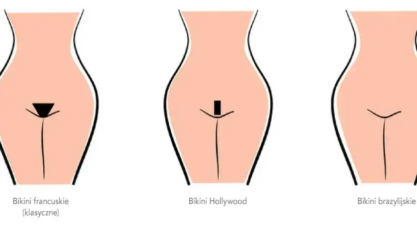 Depilacja laserowa bikini: Ile trwa? Pełny harmonogram i efekty